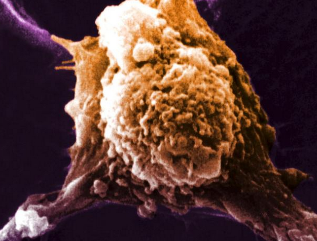 科学家发现一种新方法制作抗癌疫苗